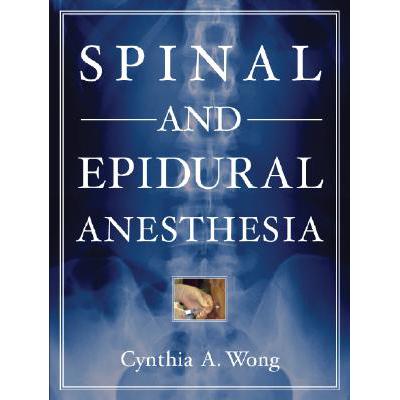 预订 Spinal and Epidural Anesthesia