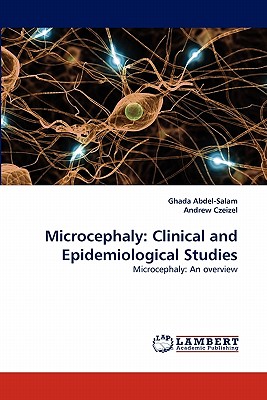 Microcephaly: Clinical an