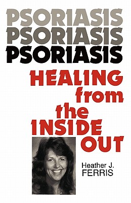 【预订】psoriasis healing from the inside