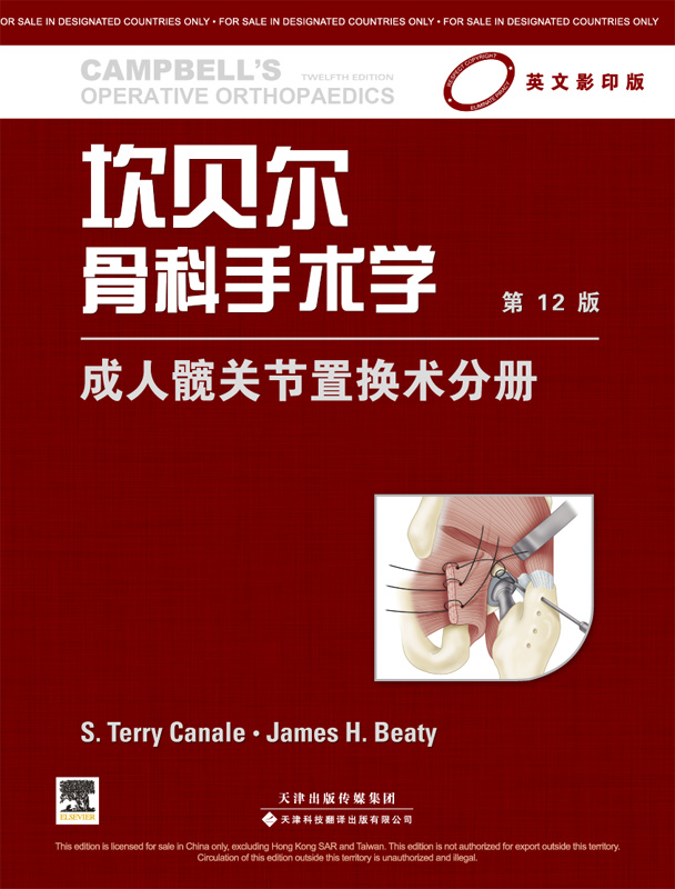 坎贝尔骨科手术学：成人髋关节置换术分册（影印版）（第12版）（国外引进）