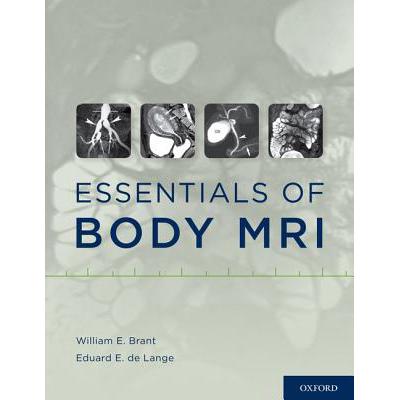 预订 Essentials of Body MRI