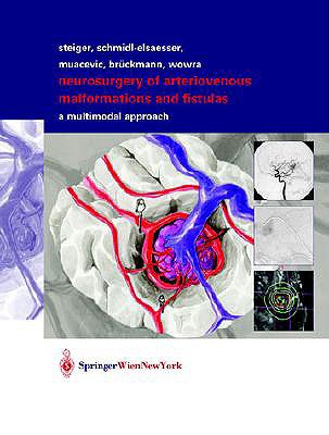 【预订】neurosurgery of arteriovenous