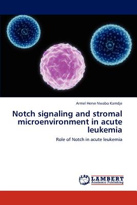 Notch Signaling and Stromal