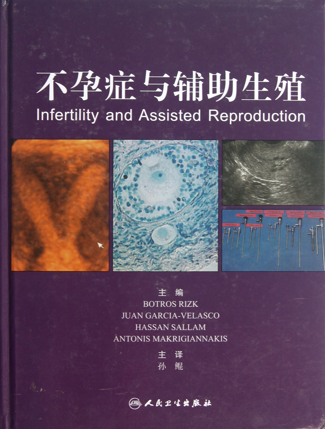 不孕症与辅助生殖(精)