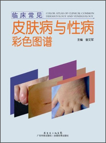 正版 临床常见皮肤病与性病彩色图谱 9787535962591