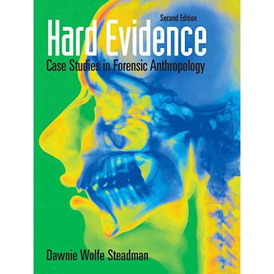 预订 Hard Evidence : Case Studies in Forensic Ant...