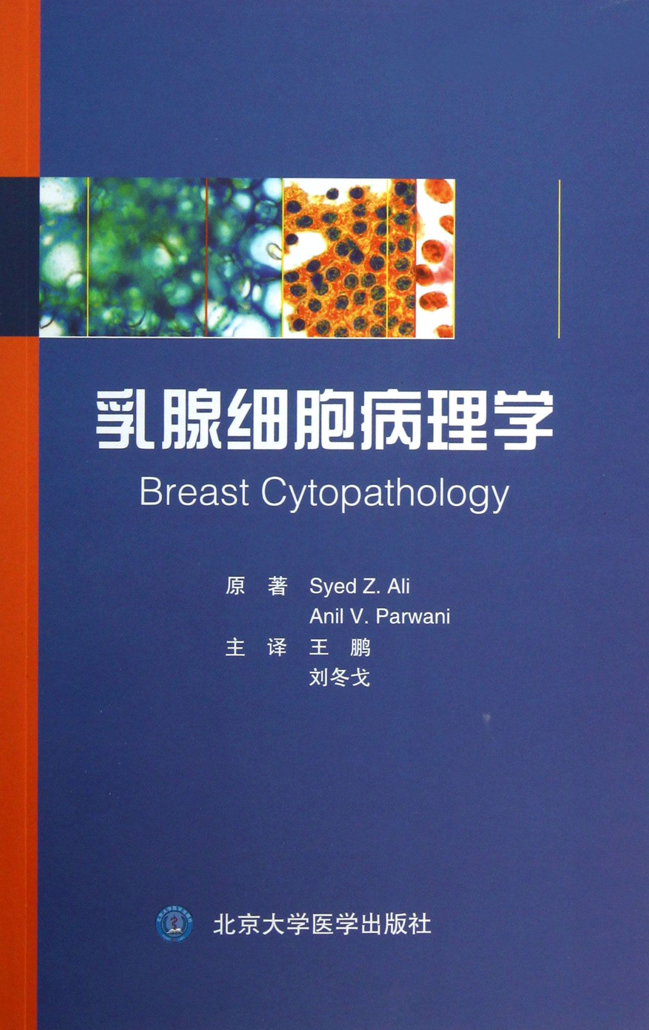 乳腺细胞病理学