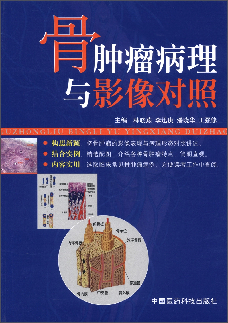 骨肿瘤病理与影像对照