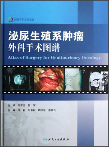 泌尿生殖系肿瘤外科手术图谱