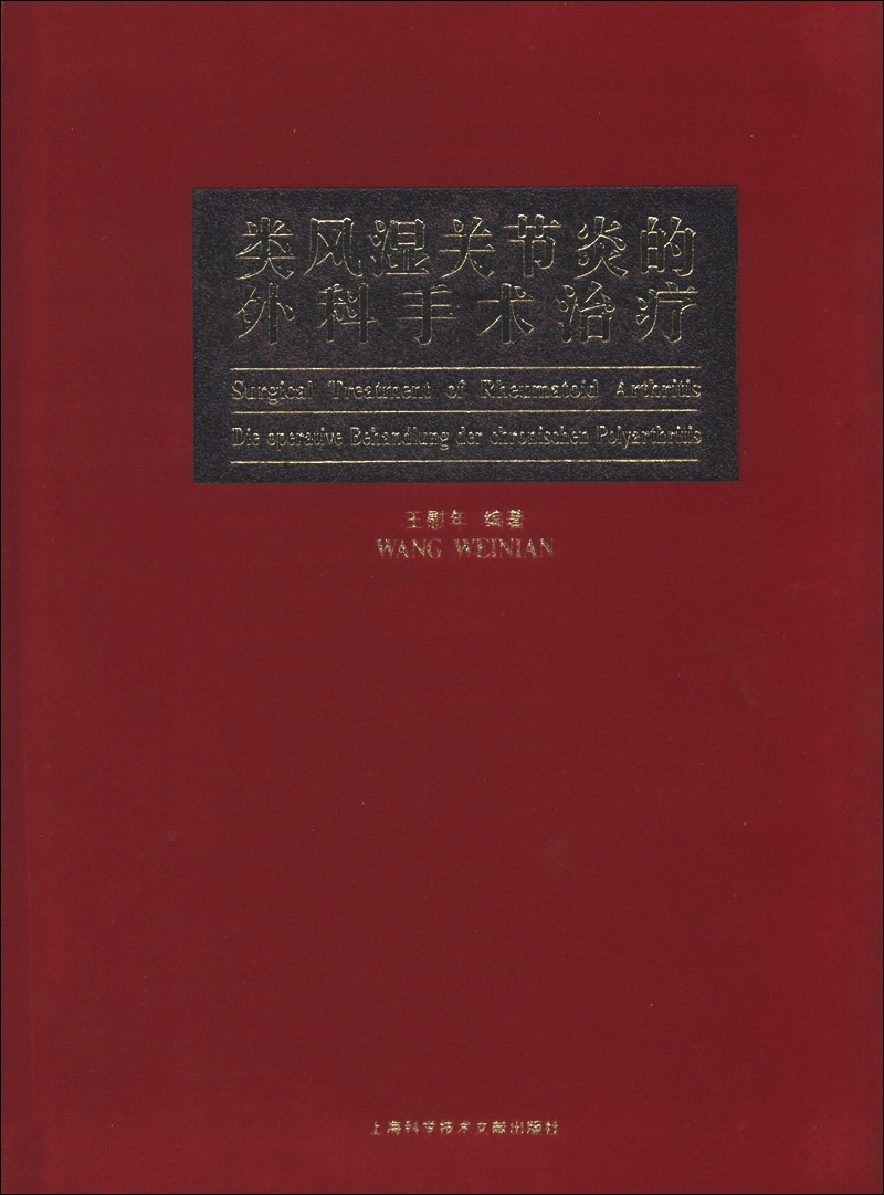类风湿关节炎的外科手术治疗