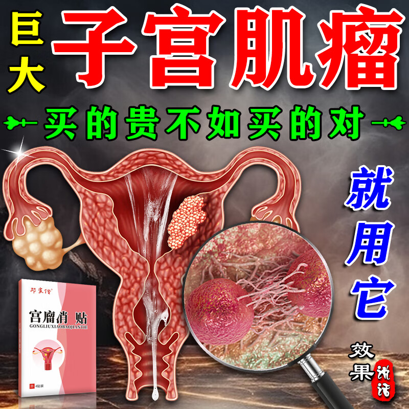 卵巢囊肿子宫内膜息肉月经不调白带异常出血热敷膏药贴 4盒只要2盒钱