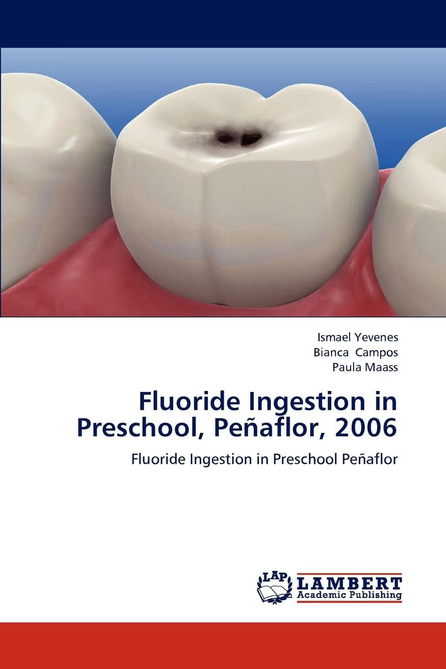 【2周达】预售 按需印刷 fluoride ingestion in preschool, penaflor