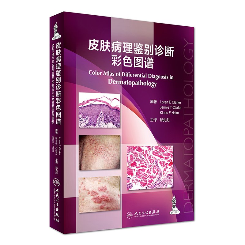 皮肤病理鉴别诊断彩色图谱