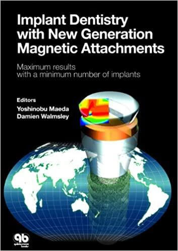 预订implant dentistry with new generation magnetic a