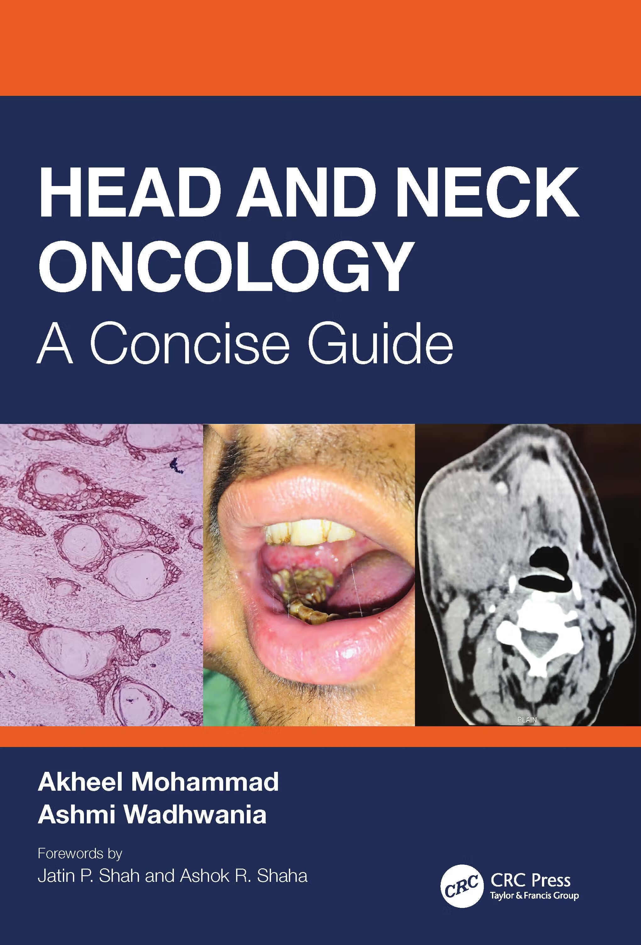 预订 head and neck oncology