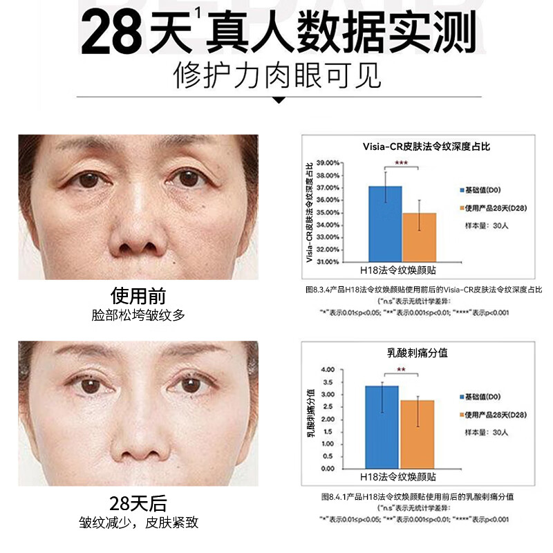 斐丽法令纹贴抗皱面膜女男士提拉紧致淡化细纹皱纹补水保湿1.5g*12片