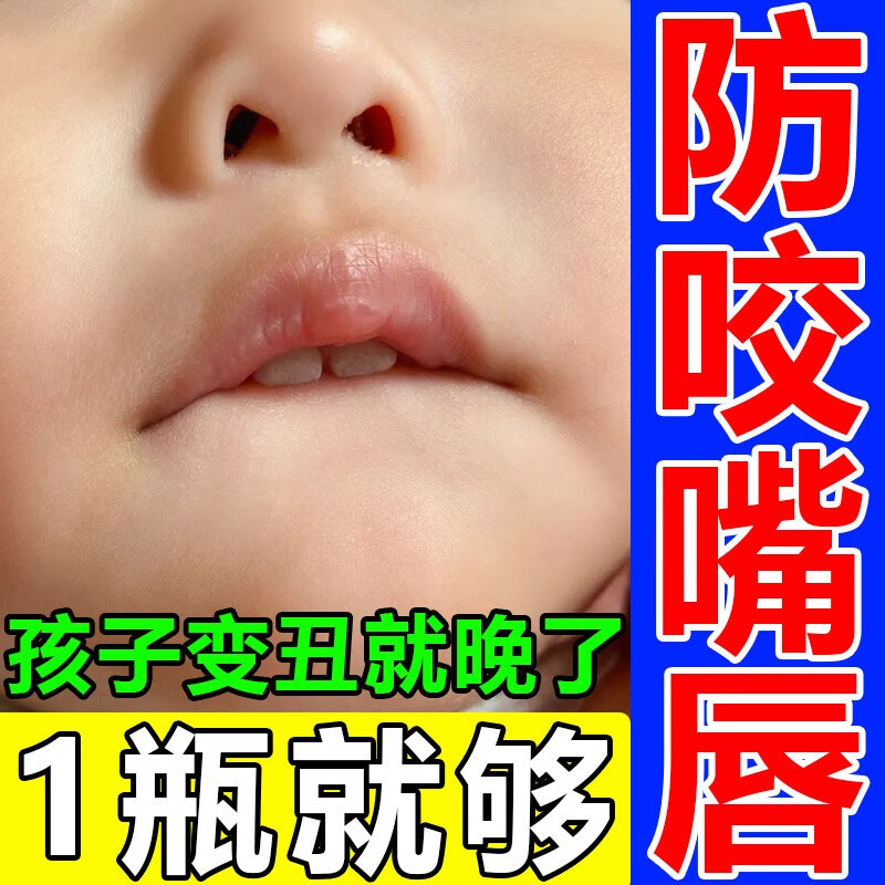 药房直售 防止小孩咬下嘴唇神器苦瓜水咬嘴唇宝宝婴儿坏习惯 1盒一抹