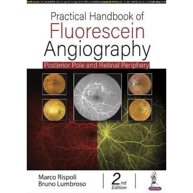 【4周达】practical handbook of fluorescein angiography
