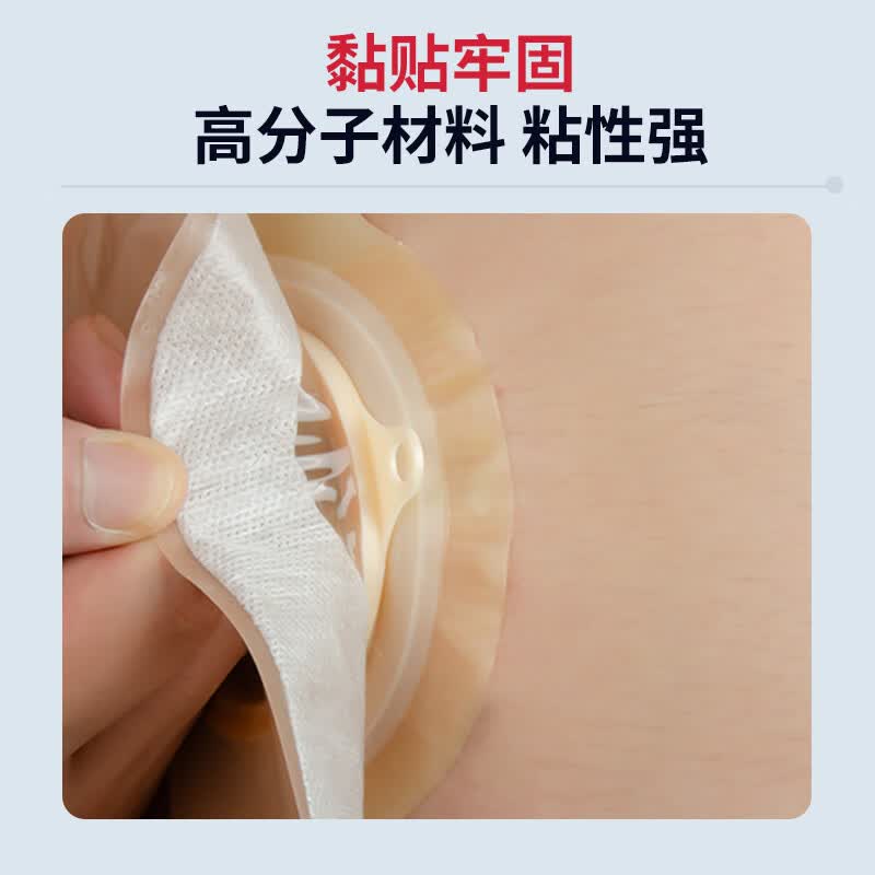 护士同学一件式微凸底盘造口袋一次性凸面可排气大便袋肛肠防凹陷造瘘袋 活性炭款【5片】微凸底盘+送棉签