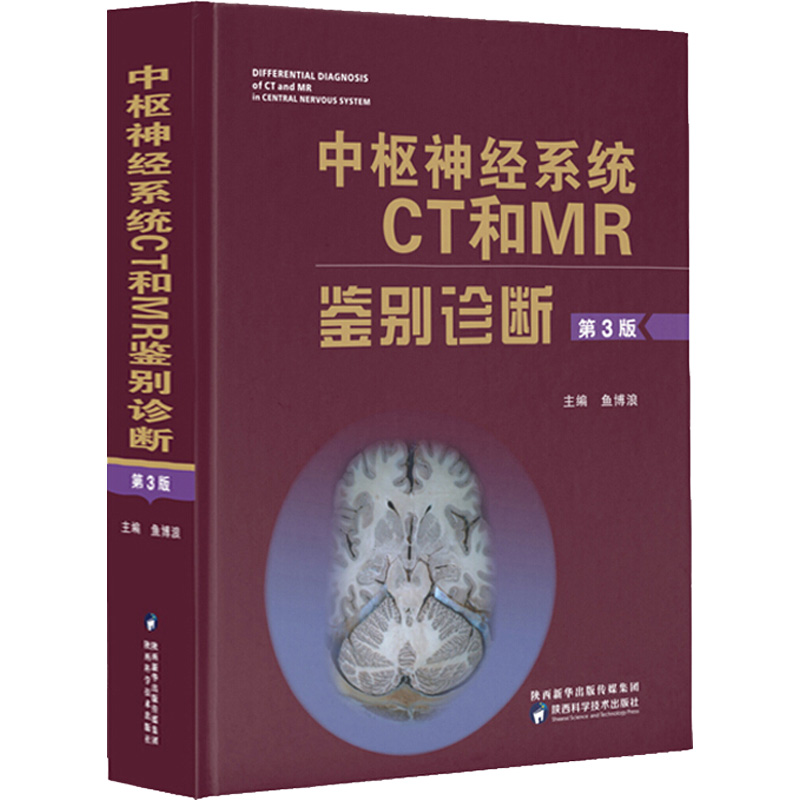 中枢神经系统CT和MR鉴别诊断(第3版)