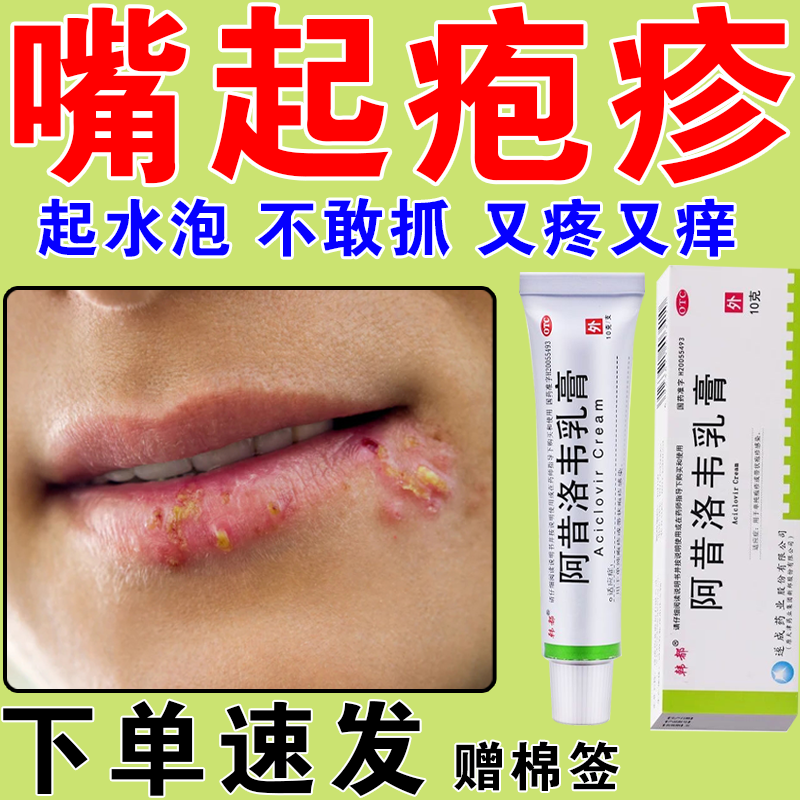 【治疱疹药】嘴巴起泡嘴唇疱疹瘙痒红肿嘴角上火起疱疹又疼又痒一动就