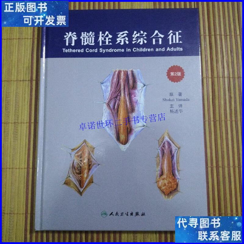 【二手9成新】脊髓栓系综合征(第2版) /秀克 人民卫生出版社