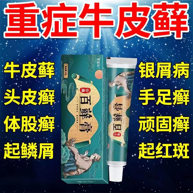 remeverse百藓膏牛l皮l癣头皮l癣手足l癣体股l癣湿l疹皮l炎外用痒膏