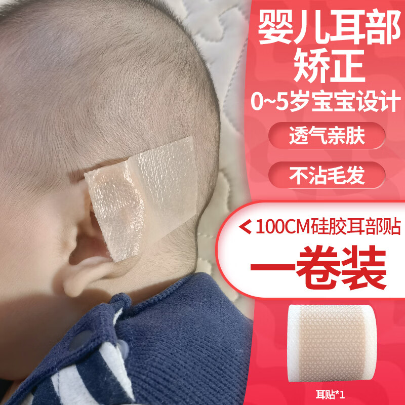 新生儿耳朵矫正器婴幼儿童宝宝耳夹定型器外耳招风耳贴垂耳撑硅胶 100