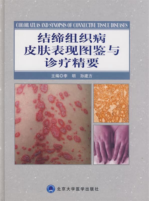 结缔组织病皮肤表现图鉴与诊疗精要