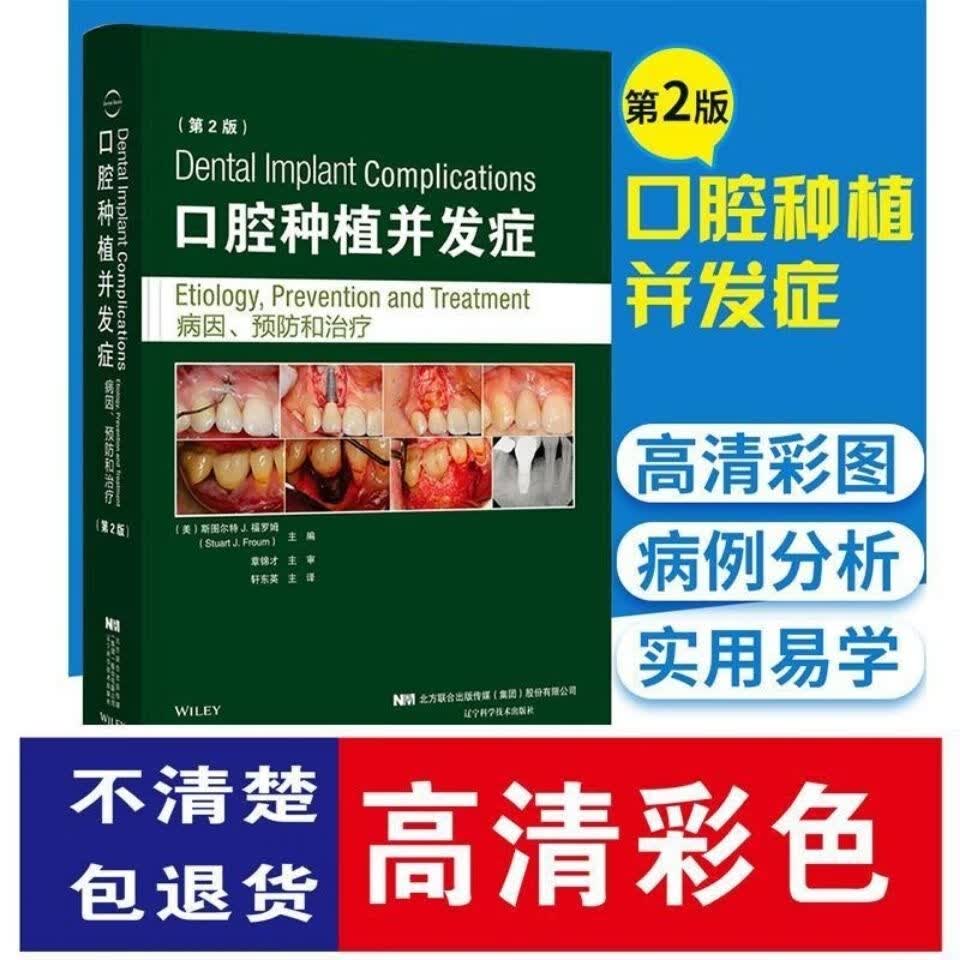 口腔种植并发症 病因、预防 第二版 (彩色)