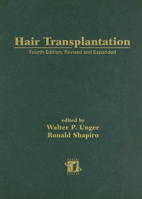 预订 hair transplantation, fourth edition