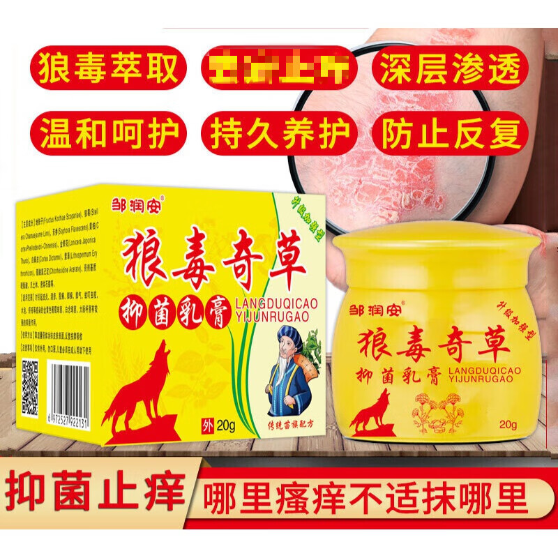 ojm官方狼毒奇草乳膏20g皮肤瘙痒大腿内侧 清肌脚痒狼毒软膏 初患装1