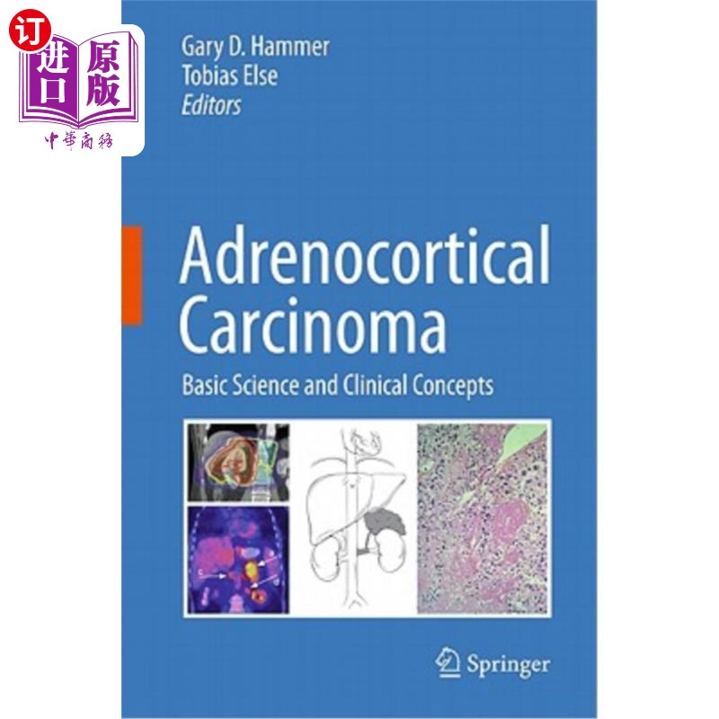 carcinoma: basic science and clinical concepts 肾上腺皮质癌