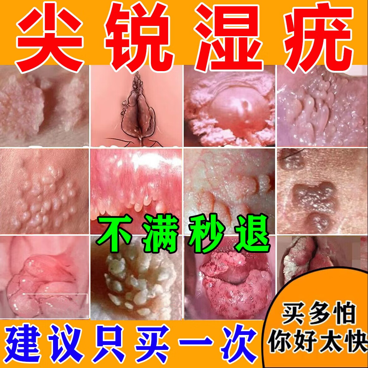 高危药增强免疫力凝胶男女性私处疱疹珍珠疹干扰素治疗生物蛋白敷料