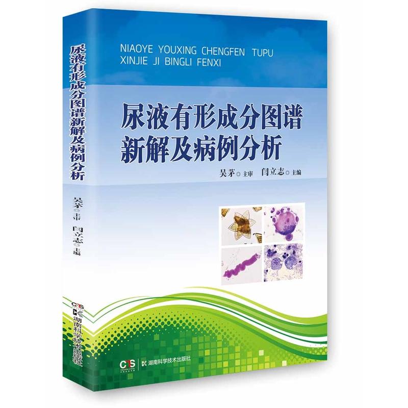 正版 尿液有形成分图谱新解及病例分析 检验科医生实用工具书 医学体液细胞形态学书籍 尿液成分分析实用技术高性价比高么?