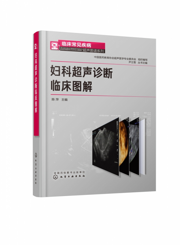 妇科超声诊断临床图解(精)/临床常见疾病超声图谱系列
