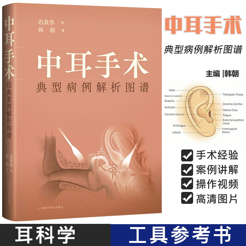 中耳手术典型病例解析图谱 上海科学技术出版社