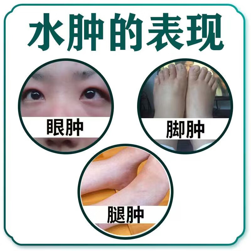 小腿水肿消肿腿浑身水肿祛水肿脸肿四肢浮肿走路困难六味能消丸-wjl