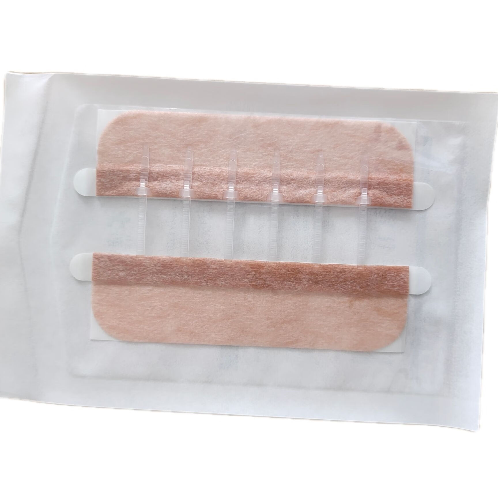 捷拉皮肤减张器医用皮肤表面缝合器立辰皮肤吻合器减张贴医用术后 长