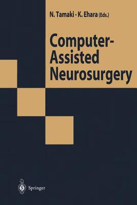 预订 computer-assisted neurosurgery