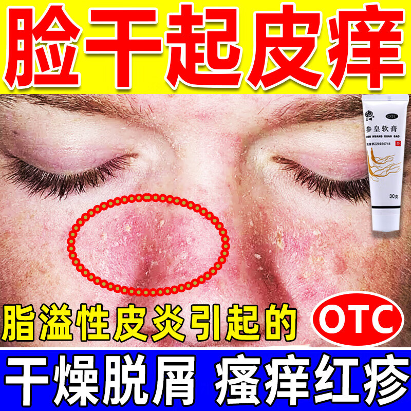 皮肤干燥男女脸干脱皮碎屑泛红痒过敏止痒专用药养血润燥 参皇软膏 3