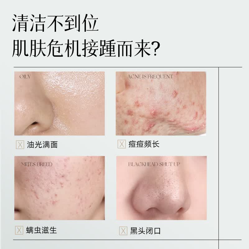Andwarm进口洗面奶150g氨基酸美白除螨祛痘控油男女士去黑头缩毛孔洁面乳 【螨虫油痘克星】1瓶装