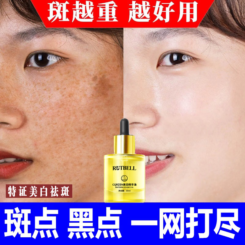 RUTBELL美白祛斑精华油提亮肤色淡化晒斑雀斑黄褐斑老年斑面部精华液 1瓶【建议按疗程购买】