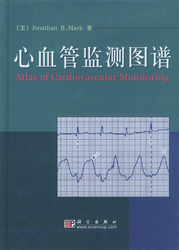 心血管监测图谱