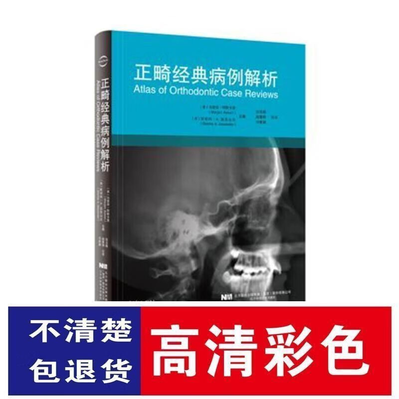 高清彩色 正畸经典病例解析