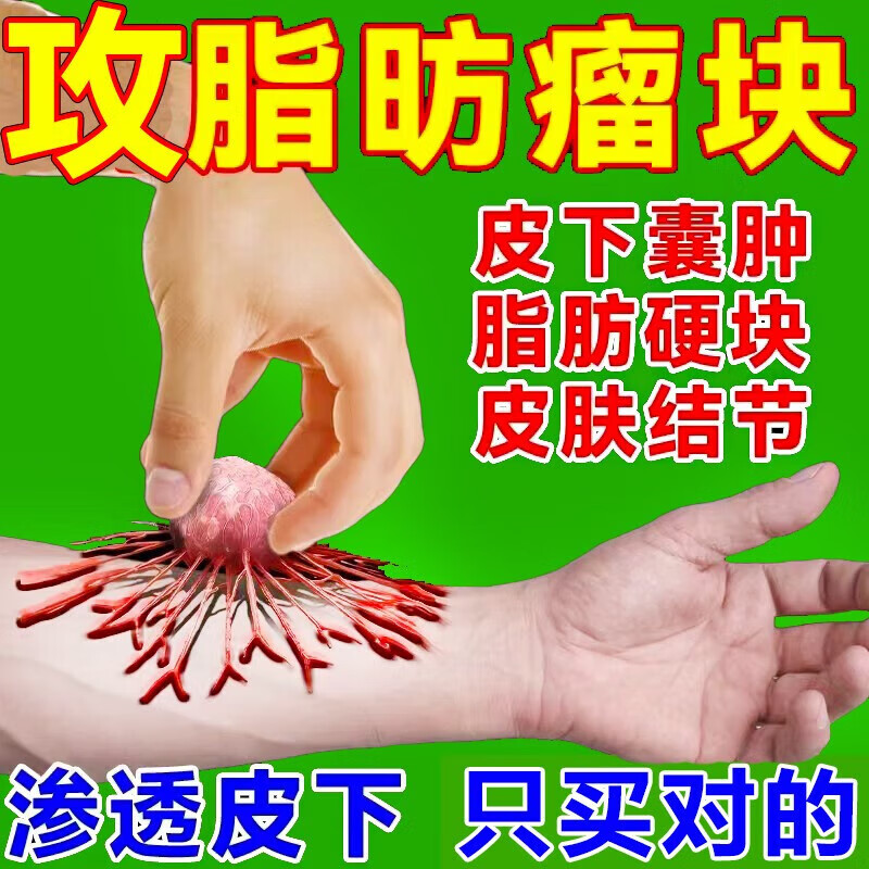 【官方】官方器械脂肪瘤去除膏专用神器药硬块3天消专消36种皮下多发