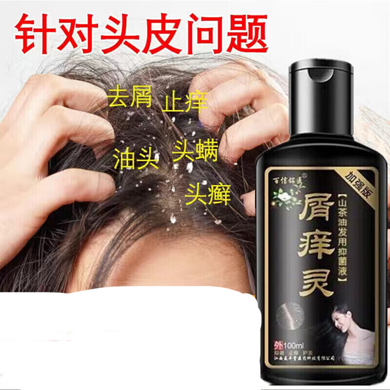 头皮癣治疗头部专用药膏洗发水牛皮癣银屑癣外用真菌感染头皮藓药