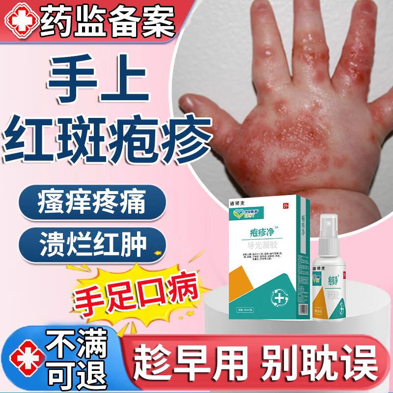 祥医堂手足口病专的用药儿童重组人干扰素a2b凝胶疱疹性咽峡炎用药