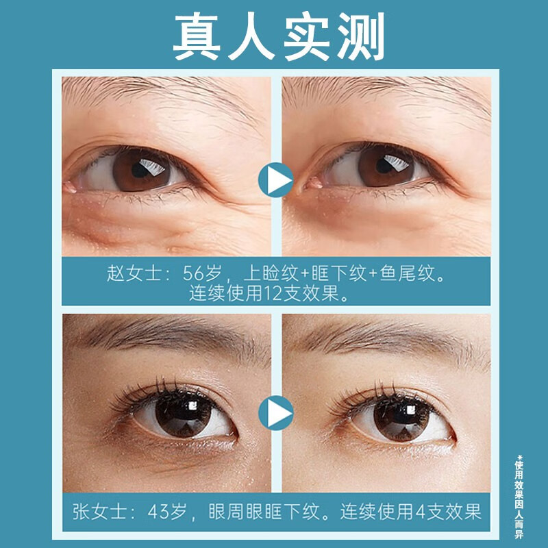 美颜坊国药集团天目湖多效舒润眼霜男士专用淡化细纹提拉紧致黑眼圈眼袋 【第2支10】消去抗皱眼霜大品牌