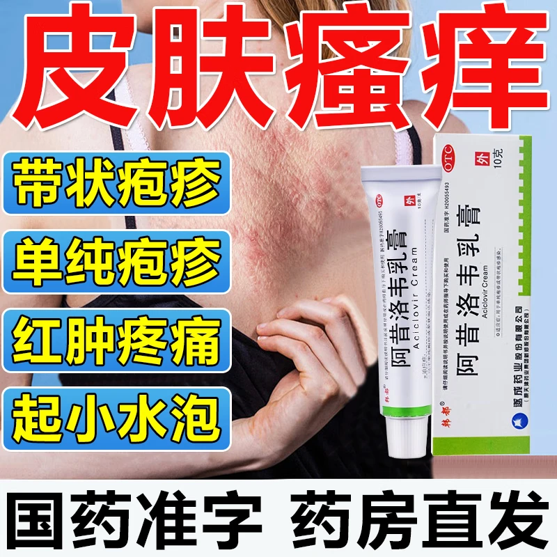 阿昔洛韦乳膏治疗水痘单纯疱疹细菌病毒感染生殖器疱疹瘙痒嘴唇嘴角